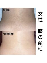 フルール(fleur)/気になる箇所の選べる部分脱毛