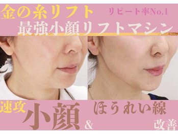 ムーンライズ(moonrise)/