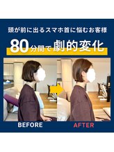 ヒューマンストレッチ 京都錦店(Human Stretch)/頭が前にスマホ首の原因は肩甲骨