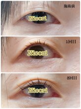 ニコリ(Nicori)/アイリッドアップパーマ