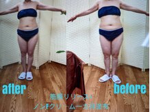ビューティサロン オハナ(ohana)の雰囲気（筋膜リリースで肩こり浮腫み冷え姿勢の改善で華奢見え♪美脚も◎）