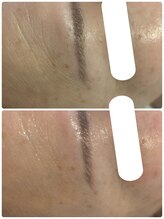 エルール トータルビューティ(Aileure total beauty)/ララピール