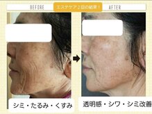 【結果重視】様々からアプローチで立体的小顔&肌質改善へ！