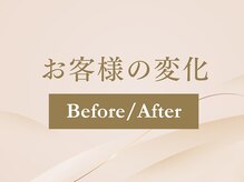 アレイズ(Alaise)/整体Before/After