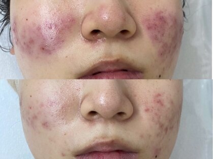 マインドテラピー 高田馬場の写真