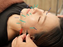 パーソナルケア マエダ(PERSONAL CARE MAEDA)の雰囲気（整体×美容鍼で当院しかできないリフトアップを是非お試し下さい）