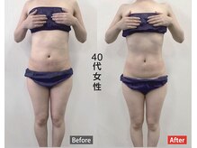 ワイズ(Y's)/お腹周り