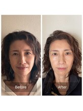 かぐや(salon)/ビフォーアフターのお写真