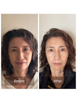 かぐや(salon)/ビフォーアフターのお写真