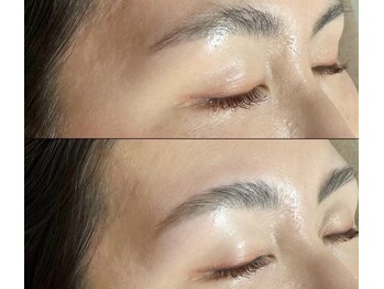 アンドエス 六本木(and S.)/女性ハリウッドブロウリフト