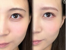 チル アンド アイ 船橋駅前店(Chill&Eye)/美眉スタイリング/BeforeAfter