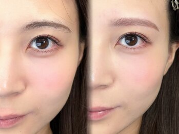 チル アンド アイ 船橋駅前店(Chill&Eye)/美眉スタイリング/BeforeAfter