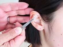 ベル(Belle)の雰囲気（ツボに金粒を目立たないテープで貼ります♪）