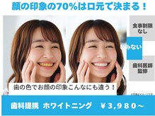 ホワイトニングカフェ 綾瀬店(WhiteningCafe)