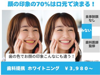 ホワイトニングカフェ 綾瀬店(WhiteningCafe)