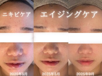 アールエーサロン 恵比寿 広尾(Ra salon)/肌ケアからエイジングケアまで