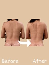 ベルペール(Belle perle)&nbsp;ハンド セラピス