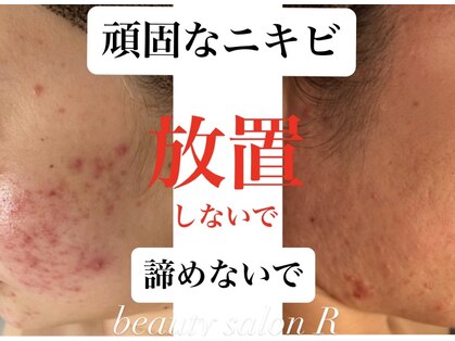ビューティサロン アール(R)の写真