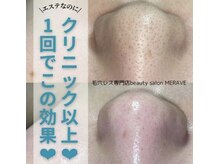 ミラーヴ(MERAVE)/技術コンテスト受賞の仕上がり！