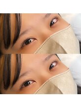 ミュー(professional beauty salon MYU)/まつ毛パーマ/ラッシュリフト