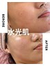 【夏限定】毛穴×乾燥×くすみ◎水光ピーリング＋美白パックで潤いチャージ