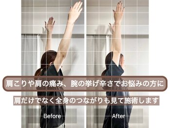 スプリング鍼灸院(Spring鍼灸院)/30代主婦/肩こり/肩の痛み