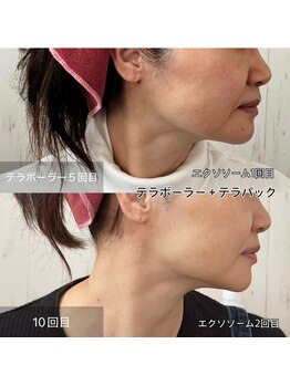 ルビーミー(Ruby's Me)/