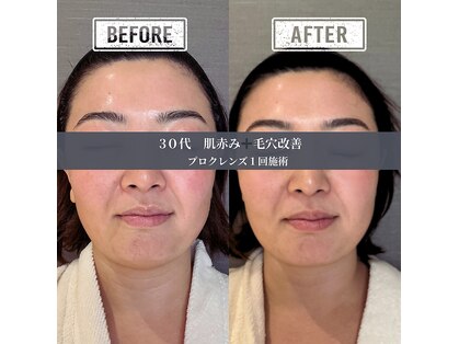 サトミスキンケアスタジオ(satomi skincare studio)の写真