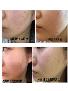 プリマプリート WEST店/VOSサロンケア