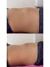 キララ(Kirara)/一回の変化！