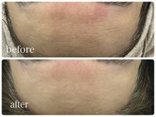 グラン ジュテ/キャビアアンプル×LDM