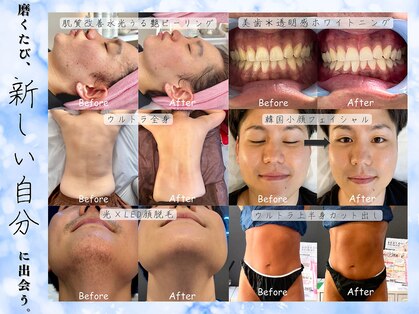 アイディー(Id)の写真