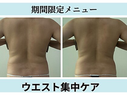 エクラニーク(Eclanique)の写真