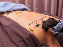 ごえん 四日市店/はりきゅうとほぐし