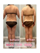 サロン ド フェイス モアナ(Salon de Faith Moana)/キャビテーション痩身【50代】