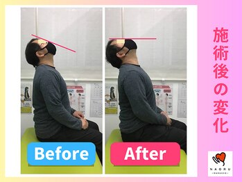 ナオル整体 川越院(NAORU整体)/上を向くのが楽に【整体/矯正】