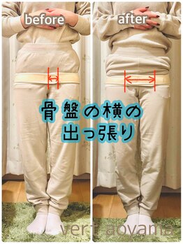 ヴェール 青山(vert)/骨盤矯正ビフォーアフター