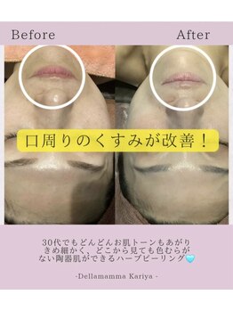 オペラ 刈谷店/お客様のビフォーアフター☆