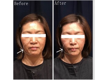 たくろう鍼灸院 豊田本院/Before&After