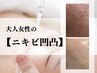 繰り返す大人女性の【ニキビ/ニキビ凹凸】フェイシャル 90分　19,800→13.860