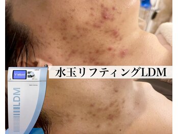 ヴェアリー 広尾(VARY)の写真/意外とちゃんと見られてる肌。肌も綺麗に管理出来てる男性が素敵です