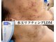 ヴェアリー 広尾(VARY)の写真/意外とちゃんと見られてる肌。肌も綺麗に管理出来てる男性が素敵です