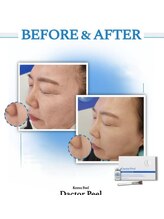 ドルチェビューティーサロン 戸塚安行店(Dolce Beauty Salon)/ダクトピール