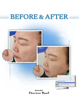 ドルチェビューティーサロン 戸塚安行店(Dolce Beauty Salon)/ダクトピール