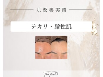 スリースリー 恵比寿(THREE THREE)/テカリ・脂性肌ケア改善実績写真
