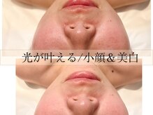 シャルール プラス(Chaleur+)の雰囲気(専用のフィルターでなりたいを叶える)