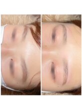 アールイーエム(R.E.M)/眉毛のお手入れしてみませんか。