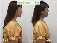 オズ六本木の雰囲気（首から整えるので姿勢も良くなる小顔矯正☆首コリ緩和も♪＠小顔）