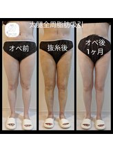 アリビオ(ALIVIO)/美容施術前後ケア