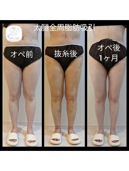 アリビオ(ALIVIO)/美容施術前後ケア